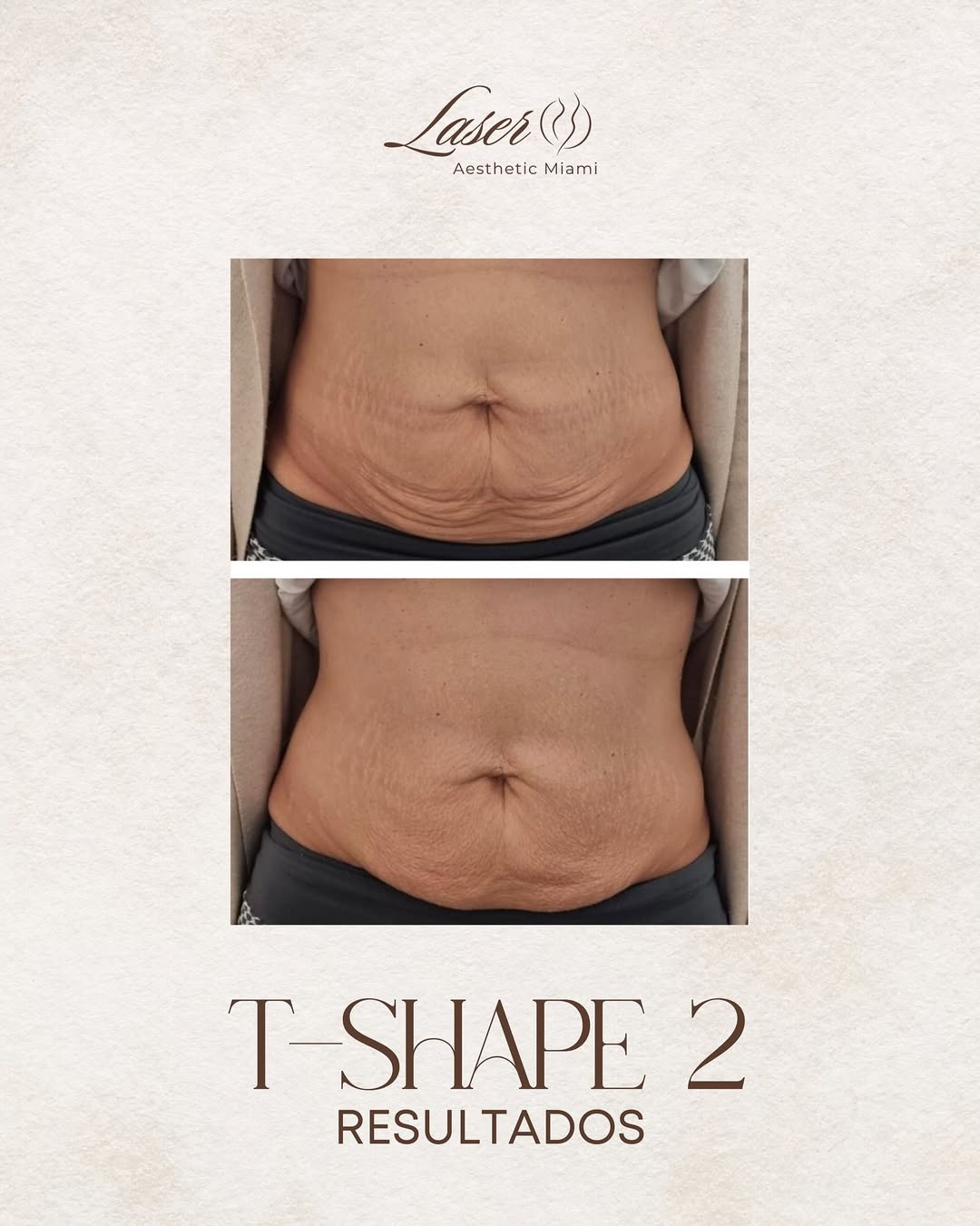 T-Shape 2 results